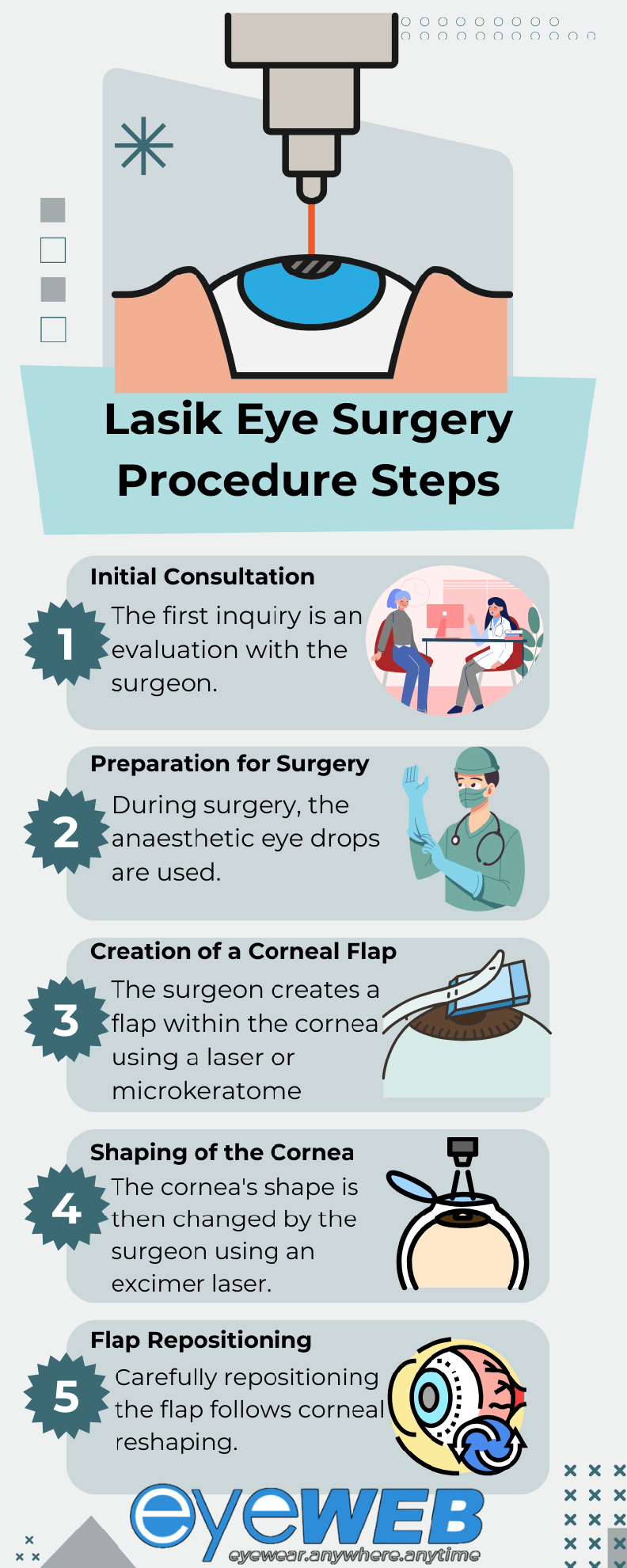 Lasik Eye Surgery Procedure Steps